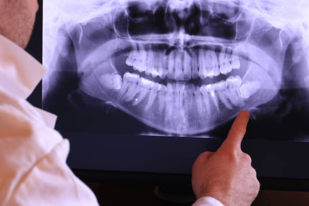 Best Emergency Dental Extractions in Greensburg, IN