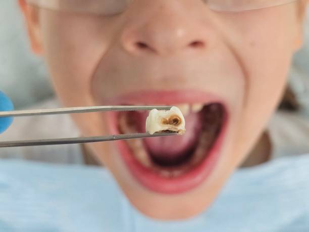 Best Holiday Emergency Dentist in Greensburg, IN